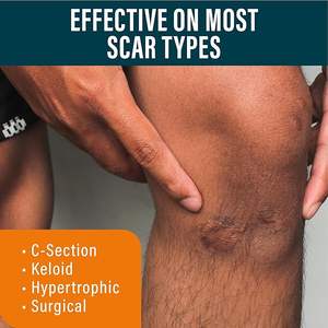Proveedor caliente Private Label Advanced Scar Gel Apoya la regeneración de la <span class=keywords><strong>piel</strong></span> Reduce visiblemente las cicatrices Producto de belleza y cuidado personal - Product Image 2