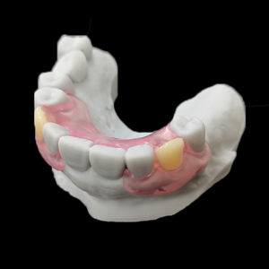 Vente en gros de prothèses dentaires Valplast amovibles flexibles en acrylique, externalisation de laboratoire dentaire en Chine, prix bon marché pour Agnet dentaire - Product Image 6