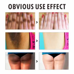 Handelsmarke O'Carly Knuckle White ning Set Hautpflege Schönheits produkte Körper lotion Gesichts serum Seifen creme Kosmetik - Product Image 6