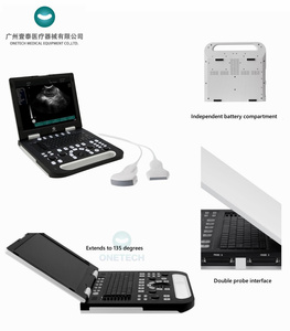 B53 giá thấp SONOSCAPE xách tay siêu âm DOPPLER Máy quét cho doanh số bán hàng - Product Image 4