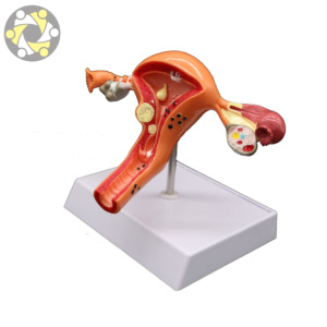 Modèle d'anatomie génitale féminine-Utérus et ovaire artificiels pour <span class=keywords><strong>l</strong></span>'étude des sciences médicales - Product Image 5