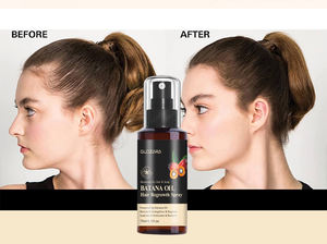 Vente en gros OEM Vegan <span class=keywords><strong>Spray</strong></span> d'huile de batana pour la repousse des <span class=keywords><strong>cheveux</strong></span> Huile anti-chute Essence de <span class=keywords><strong>cheveux</strong></span> <span class=keywords><strong>Spray</strong></span> pour la repousse des <span class=keywords><strong>cheveux</strong></span> pour femmes hommes - Product Image 3