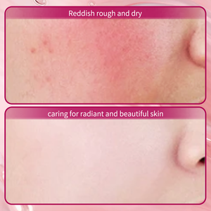 <span class=keywords><strong>Hydrolat</strong></span> <span class=keywords><strong>de</strong></span> <span class=keywords><strong>Rose</strong></span> <span class=keywords><strong>de</strong></span> Damas Hydratant Formule Douce Pure Dew Toner 100% Pure Extrait d'huile essentielle <span class=keywords><strong>Eau</strong></span> florale <span class=keywords><strong>de</strong></span> <span class=keywords><strong>Rose</strong></span> <span class=keywords><strong>Hydrolat</strong></span> - Product Image 6