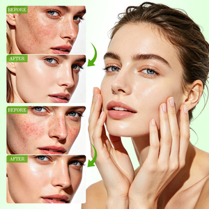 Tonique Apaisant OEM à l'Aloe PDRN Marque Blanche : Apaise les Rougeurs, Hydrate, Répare, Contrôle le Sébum, Resserre les Pores, Stabilise et Fortifie - Product Image 5