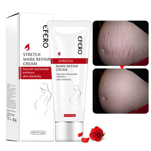 ครีมลดรอยแตกลายสูตรเข้มข้น บำรุงผิว ลดรอยแตกลายสำหรับหญิงตั้งครรภ์ - Product Image 5