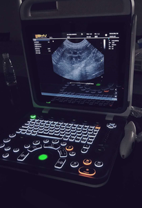 Youboll BPU60 Scanner portable de couleur, outil de contrôle à ultrasons pour médicaments, ordinateur portable - Product Image 3