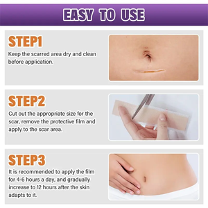 แผ่นซิลิโคนเจลปิดแผลสีผิว กันน้ำ ระบายอากาศได้ แผ่นซิลิโคนลบรอยแผลเป็นรุ่นใหม่ - Product Image 5