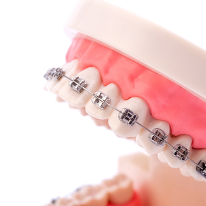 Brackets falsos para los dientes fáciles de colocar - Product Image 4