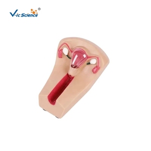 Modèle avancé de <span class=keywords><strong>formation</strong></span> en sciences médicales pour femme pour la <span class=keywords><strong>formation</strong></span> d'urgence en PVC contraceptif intra-utérin pour les étudiants médecins - Product Image 1