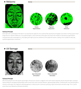 Analyseur de peau numérique 3D, analyseur de peau facial avec application - Product Image 6