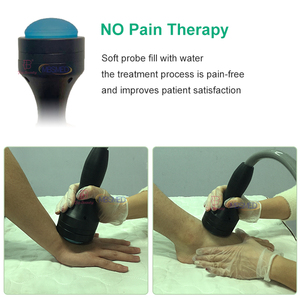Focused Soft Shockwave Eswt Ondas De Choque Focales Shock Wave Ed Equipo de fisioterapia para disfunción eréctil - Product Image 4
