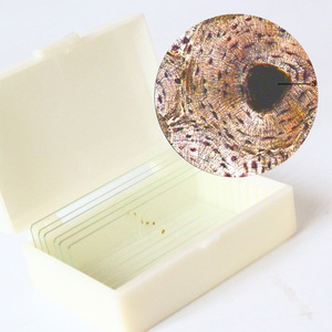 Lames microscopiques : sections clairement structurées, colorées et préparées par ponçage transversal de os frais et dur, utilisées dans la recherche scientifique. - Product Image 1