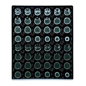 Film thermique sec pour radiographie médicale 11x14 pouces avec désinfection infrarouge lointain, classe II, approvisionnement en vrac pour distributeurs médicaux - Product Image 1