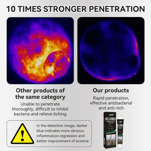 <span class=keywords><strong>Crema</strong></span> <span class=keywords><strong>para</strong></span> el Cuidado de la <span class=keywords><strong>Dermatitis</strong></span> Seborreica con Hierbas Naturales, Humectante Reparador Facial Calmante <span class=keywords><strong>para</strong></span> Cuero Cabelludo Graso - Product Image 6