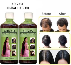 프라이빗 라벨 아디바시 탈모 방지 오일 두피 강화 유기농 발모 세럼 - Product Image 2