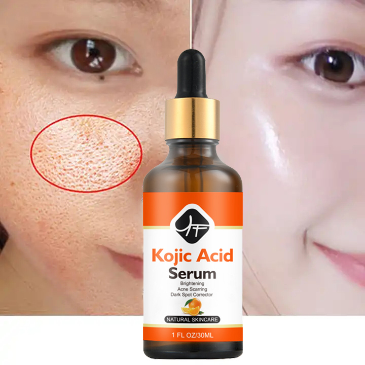 Sérum de soin de la peau à l'acide kojique à la vitamine C de marque privée Sérum de blanchiment de la peau au glutathion pour éliminer les taches brunes