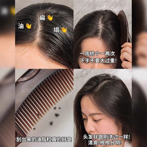 Pettine per il cuoio capelluto Energy Comb, pettine cavo per capelli oliosi, massaggio con airbag per rimuovere i residui di olio, pettine detergente, strumento per lo styling dei capelli - Product Image 4