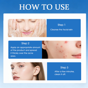 Sérum Visage Anti-âge et Anti-acné en Gros : Éclat, Réduction des Rides, Blanchissant, Apaisant et Nourrissant en Profondeur - Product Image 3