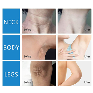 Productos de belleza Etiqueta privada Brillante para mujeres negras Producto orgánico para el cuidado de la piel Conjunto de cuidado de la piel natural Suero de crema aclarante - Product Image 4