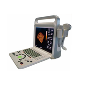 Machine de diagnostic par ultrasons Doppler couleur pour ordinateur portable E60