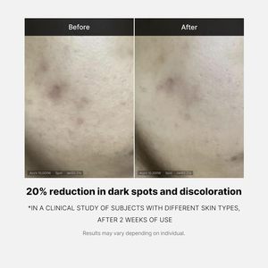 Oem ODM sâu Vita C huyết thanh 14.5% tinh khiết vitamin C làm giảm sự xuất hiện của tăng sắc tố đốm đen và nhược điểm - Product Image 5