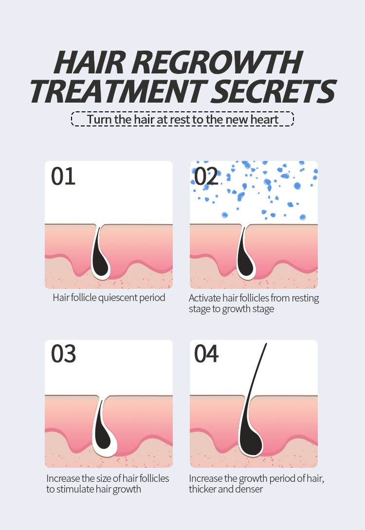 H47d0f8370ff448ff9332629cd3928f8aD 6PCS Best Selling Hit Brand best Men's Liquid Solution Topical Treatment for Thinning Hair Growth spray serum peptides