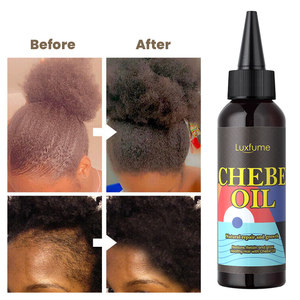 Huile Essentielle Capillaire Chebe, Huile d'Olive et Menthe pour Nourrir en Profondeur, Réparer les Follicules Pileux et Stimuler la Croissance des Cheveux pour Femmes Noires - Product Image 5