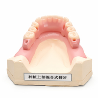 Modèle de démonstration de superstructure dentaire hybride Ecolab Dental All on 6 pour implantologie, certifié ISO pour l'étude dentaire