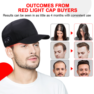 Беспроводная LED-шапка для инфракрасной терапии кожи головы 810 нм 650 нм, шапка-шлем с красным светом, NIR LED-терапия, шапка для лечения красным светом - Product Image 3