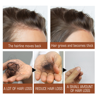 Krim Rambut Batana Label Pribadi, Nutrisi Mendalam dan Perbaikan Rambut, Mengurangi Kerontokan Rambut untuk Semua Jenis Rambut