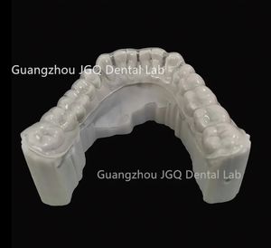 <span class=keywords><strong>Appareil</strong></span> orthodontique avec gardes de <span class=keywords><strong>nuit</strong></span> de haute qualité <span class=keywords><strong>pour</strong></span> attelle occlusale - Product Image 3