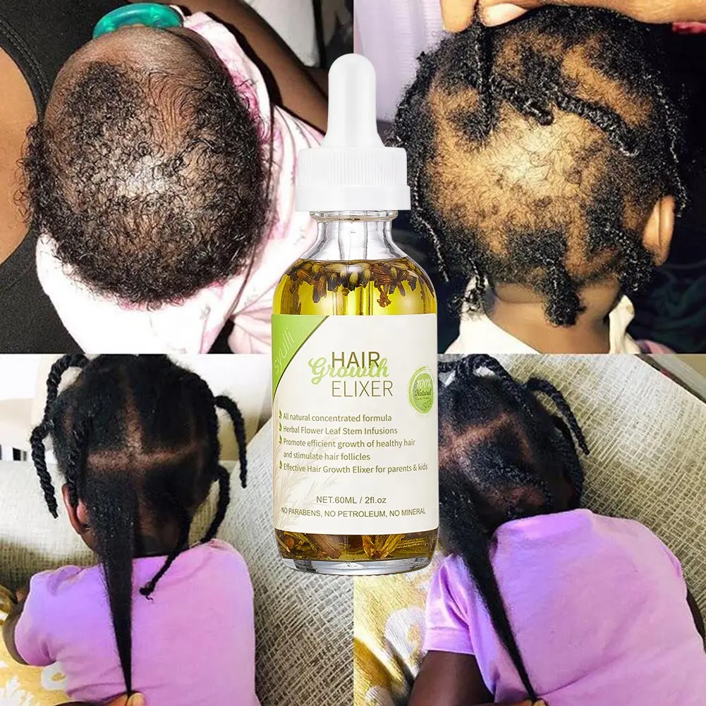 Meilleure huile capillaire biologique naturelle à base d'herbes de ricin romarin, traitement du cuir chevelu, repousse rapide, huile de croissance des cheveux de bébé pour femmes noires