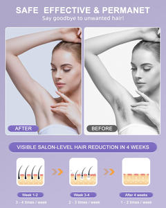 <span class=keywords><strong>Ipl</strong></span> מכונת <span class=keywords><strong>ipl</strong></span> ללא כאבים קרח קירור קבוע מכשיר להסרת שיער מכשיר נייד דפילציה לייזר הביתה להשתמש להסרת שיער בלייזר עבור גוף הפנים - Product Image 6