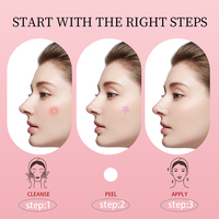 3 tailles (8 mm, 10 mm, 12 mm) Patchs anti-acné hydrocolloïdes imperméables, cruelty-free et vegan, pour une guérison rapide des boutons.