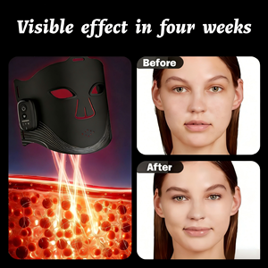 Appareil de beauté pour le <span class=keywords><strong>visage</strong></span> à domicile 2026 Nouveau <span class=keywords><strong>Masque</strong></span> facial sans fil tout-en-un anti-âge et anti-acné avec minuteur pour les soins de la peau à domicile - Product Image 4