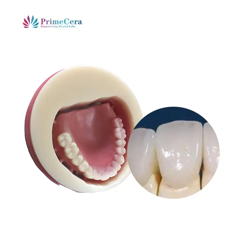 PrimeCera Materiales dentales de alta calidad Disco de PMMA flexible en laboratorio dental Sistema CAD CAM Fresado en blanco