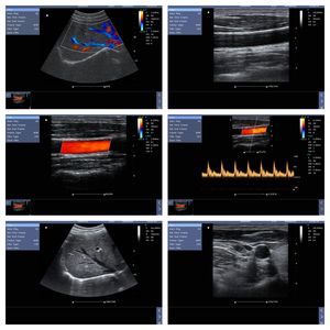 15 Inch Veterinaire Echocardiografie Machine Menselijk Gebruik Cardiale 3d/4d Veterinaire Kleur <span class=keywords><strong>Doppler</strong></span> Echografie Draagbare - Product Image 5