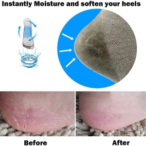 Calcetines Hidratantes con Gel para Talones Secos y Agrietados, Calcetines de Silicona para Spa, Ideales para el Dolor de Talones y Talones Secos y Agrietados - Product Image 4