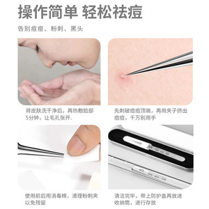 Vente en gros d'usine de produits ultra-précis n° Pince à épiler à 5 embouts pour éliminer les points noirs, l'acné et les comédons fermés - salon de beauté - Product Image 4