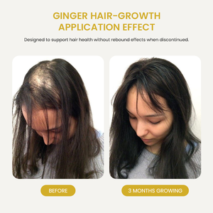 Orgânica Sophora Flavescens gengibre crescimento do cabelo soro OEM Professional Care Strong <span class=keywords><strong>Root</strong></span> Hair Loss prevenção para cabelos crespos secos - Product Image 5