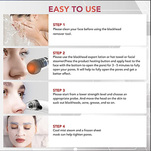 เครื่องดูด<span class=keywords><strong>สิว</strong></span>เสี้ยนและสิวอุดตันแบบไฟฟ้า ราคาประหยัด สำหรับแบรนด์ส่วนตัว ช่วยทำความสะอาดรูขุมขน กำจัดสิวหัวดำและ<span class=keywords><strong>สิว</strong></span>หัวขาว - Product Image 6