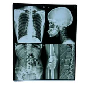 Film thermique médical 8x10 pouces pour <span class=keywords><strong>Agfa</strong></span> Drystar 5302 avec puce - Product Image 3