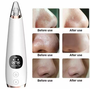 Limpiador de mano para la nariz, removedor de espinillas al vacío, impermeable, cabezal de limpieza profunda de poros, herramienta de belleza intercambiable - Product Image 6