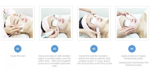 Equipo de Salón de Belleza, Jet Peel, Hidro Microdermoabrasión, Hydra Clean, Máquina de Blanqueamiento Facial y Masaje - Product Image 3