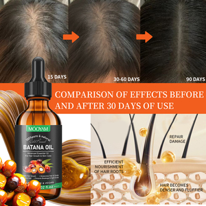 <span class=keywords><strong>Aceite</strong></span> de Romero, Jengibre, Ricino y Almendras 100% Natural y Orgánico de Marca Privada para el Cuidado del Cuero Cabelludo, Tratamiento Capilar y Crecimiento del Cabello para Hombres y Mujeres - Product Image 5