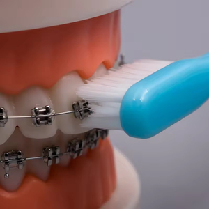 <span class=keywords><strong>Brosse</strong></span> à dents orthodontique à poils en V personnalisable en usine <span class=keywords><strong>pour</strong></span> le nettoyage buccal des appareils dentaires - Product Image 5