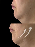 Crème Sculptante Hydratante V-Mode au PDRN et Peptides avec Rouleau Gua Sha Intégré – Gel Facial Anti-Âge Rafraîchissant pour le Lifting du Contour du Visage