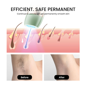 Xu hướng sản phẩm 2025 Hàng Mới Về thiết kế mới phổ biến nhất Thiết bị tẩy lông IPL - Product Image 6