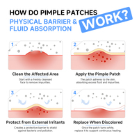 Patch anti-acné super invisible, patch anti-acné hydrocolloïde en forme mignonne, patch anti-acné hydrocolloïde en gros pour le visage et le nez