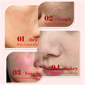 Produits de soin de la peau naturels, sérum micro-aiguilleté, sérum réparateur apaisant à la Centella, soin du visage, marque privée - Product Image 4